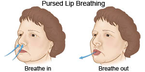 Pursed Lip Breathing